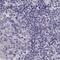 Trichohyalin Like 1 antibody, NBP2-56332, Novus Biologicals, Immunohistochemistry paraffin image 