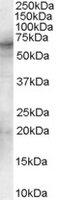 Spleen Associated Tyrosine Kinase antibody, MBS421218, MyBioSource, Western Blot image 