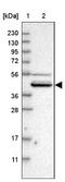 Solute Carrier Organic Anion Transporter Family Member 2B1 antibody, NBP1-80979, Novus Biologicals, Western Blot image 