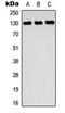 Receptor Tyrosine Kinase Like Orphan Receptor 2 antibody, LS-C358286, Lifespan Biosciences, Western Blot image 