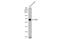 E2F-1 antibody, GTX70154, GeneTex, Western Blot image 