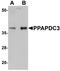 Phospholipid Phosphatase 7 (Inactive) antibody, A15380, Boster Biological Technology, Western Blot image 