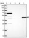 Angiopoietin Like 5 antibody, NBP1-85870, Novus Biologicals, Western Blot image 