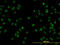 NOP16 Nucleolar Protein antibody, LS-C133758, Lifespan Biosciences, Immunofluorescence image 