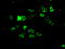 Aryl Hydrocarbon Receptor Nuclear Translocator antibody, LS-C115182, Lifespan Biosciences, Immunofluorescence image 