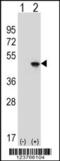 Eukaryotic Translation Initiation Factor 4A2 antibody, 63-830, ProSci, Western Blot image 