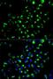Adenylate Kinase 4 antibody, LS-C748513, Lifespan Biosciences, Immunofluorescence image 