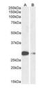 Achaete-Scute Family BHLH Transcription Factor 1 antibody, orb2001, Biorbyt, Western Blot image 