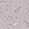 Inositol Polyphosphate-4-Phosphatase Type I A antibody, HPA001628, Atlas Antibodies, Immunohistochemistry paraffin image 