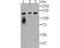 Lipin 1 antibody, A02467-1, Boster Biological Technology, Western Blot image 