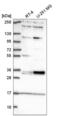 Tetraspanin 11 antibody, NBP2-57481, Novus Biologicals, Western Blot image 