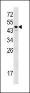 Serpin Family A Member 7 antibody, PA5-13673, Invitrogen Antibodies, Western Blot image 