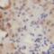 ADP Ribosylation Factor Like GTPase 6 antibody, FNab00817, FineTest, Immunohistochemistry paraffin image 