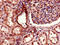 Transforming Growth Factor Beta Receptor Associated Protein 1 antibody, LS-C399832, Lifespan Biosciences, Immunohistochemistry paraffin image 