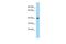 Carbohydrate Sulfotransferase 11 antibody, A06244, Boster Biological Technology, Western Blot image 