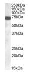 Zinc Finger DHHC-Type Containing 13 antibody, orb18960, Biorbyt, Western Blot image 