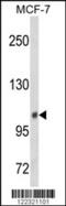 Inositol Polyphosphate-4-Phosphatase Type II B antibody, MBS9203625, MyBioSource, Western Blot image 
