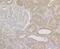 NAD(P)H Quinone Dehydrogenase 1 antibody, NBP2-80395, Novus Biologicals, Immunohistochemistry paraffin image 