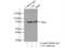 Carbonic Anhydrase 9 antibody, 11071-1-AP, Proteintech Group, Immunoprecipitation image 