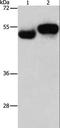 Archaelysin Family Metallopeptidase 1 antibody, LS-C406142, Lifespan Biosciences, Western Blot image 