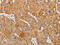 BCL2 Interacting Protein 3 antibody, CSB-PA084239, Cusabio, Immunohistochemistry paraffin image 