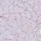 Solute Carrier Family 39 Member 6 antibody, NBP2-13337, Novus Biologicals, Immunohistochemistry paraffin image 