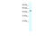 Tripartite Motif Containing 39 antibody, 28-183, ProSci, Enzyme Linked Immunosorbent Assay image 