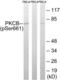 Protein Kinase C Beta antibody, LS-C199458, Lifespan Biosciences, Western Blot image 