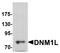 Dynamin 1 Like antibody, A00556, Boster Biological Technology, Western Blot image 
