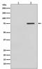 Raf-1 Proto-Oncogene, Serine/Threonine Kinase antibody, P00446-4, Boster Biological Technology, Western Blot image 