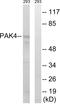 P21 (RAC1) Activated Kinase 4 antibody, LS-C117768, Lifespan Biosciences, Western Blot image 