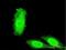 Interleukin 1 Receptor Associated Kinase 3 antibody, H00011213-M06, Novus Biologicals, Immunocytochemistry image 