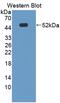 Nexilin F-Actin Binding Protein antibody, abx129329, Abbexa, Enzyme Linked Immunosorbent Assay image 