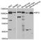 Melanotransferrin antibody, A6653, ABclonal Technology, Western Blot image 