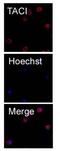 Tumor necrosis factor receptor superfamily member 13B antibody, GTX53017, GeneTex, Immunofluorescence image 