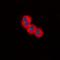 TSC Complex Subunit 2 antibody, orb338884, Biorbyt, Immunocytochemistry image 