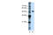 DEAD-Box Helicase 47 antibody, 29-532, ProSci, Western Blot image 