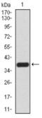 DEAD-Box Helicase 20 antibody, NBP2-52454, Novus Biologicals, Western Blot image 