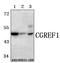 Cell Growth Regulator With EF-Hand Domain 1 antibody, A11706-1, Boster Biological Technology, Western Blot image 