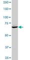 T-Box 3 antibody, H00006926-M02, Novus Biologicals, Western Blot image 