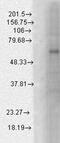 Gamma-aminobutyric acid receptor subunit beta-1 antibody, TA326473, Origene, Western Blot image 