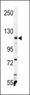 Vinculin antibody, LS-C100625, Lifespan Biosciences, Western Blot image 