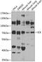 MAK-related kinase antibody, 23-180, ProSci, Western Blot image 