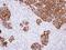 Glucosidase II Alpha Subunit antibody, NBP1-32554, Novus Biologicals, Immunohistochemistry paraffin image 