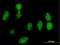 Ribosomal Protein Lateral Stalk Subunit P0 antibody, H00006175-B01P, Novus Biologicals, Immunocytochemistry image 