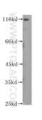 Ubiquitin Protein Ligase E3A antibody, 60038-1-Ig, Proteintech Group, Western Blot image 