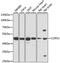 COP9 Signalosome Subunit 3 antibody, GTX33109, GeneTex, Western Blot image 