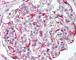 Cyclin Dependent Kinase 7 antibody, 49-217, ProSci, Immunohistochemistry paraffin image 