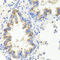 Sonic Hedgehog Signaling Molecule antibody, 23-134, ProSci, Immunohistochemistry paraffin image 