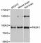 Phosphoinositide-3-Kinase Regulatory Subunit 1 antibody, abx126364, Abbexa, Western Blot image 